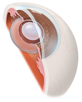 Cataract Surgery Bayside